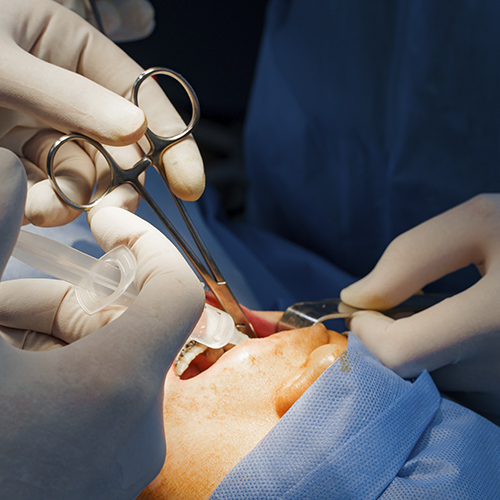 Cirurgia