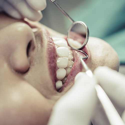 Periodontia